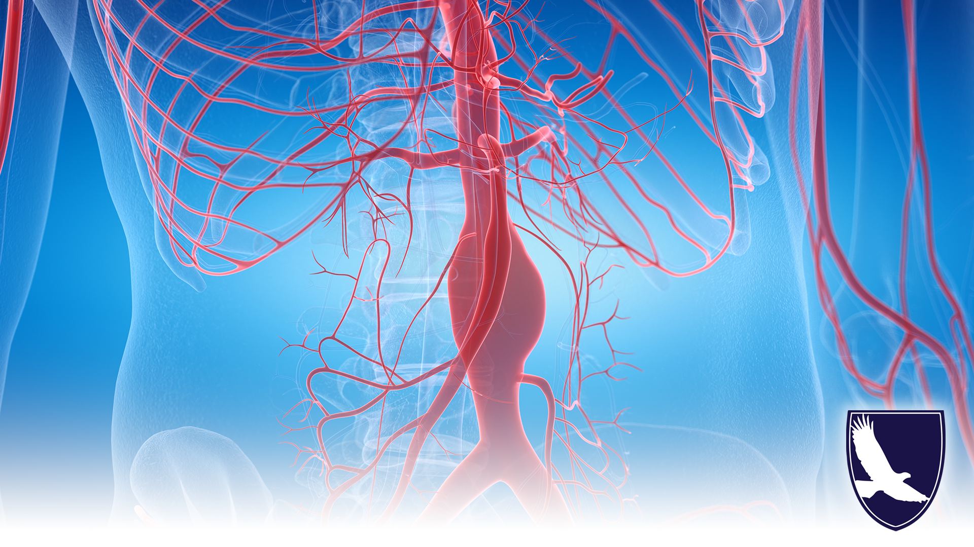 CAN I GET SOCIAL SECURITY DISABILITY FOR AORTIC ANEURYSM